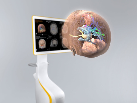 Нейронавигация Brainlab Curve Navigation