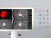 Нейронавигация Brainlab Curve Navigation