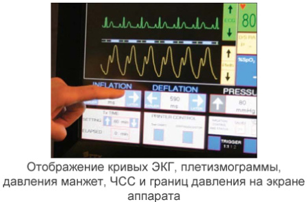 Аппарат усиленной наружной контрпульсации P-ECP/TI