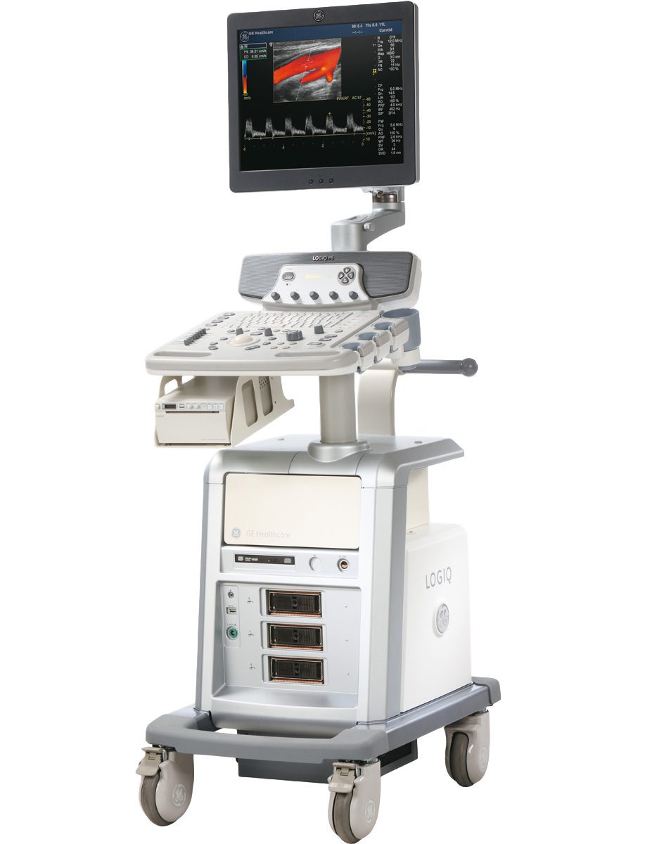 GE Logiq P6