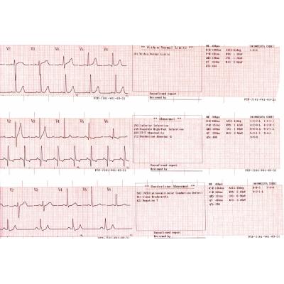Fukuda FCP-7101 CardiMax