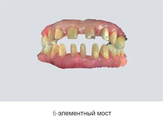 mfu0hlu806vezzv2j9qhanwtenw8sxm2.png mfu0hlu806vezzv2j9qhanwtenw8sxm2.png