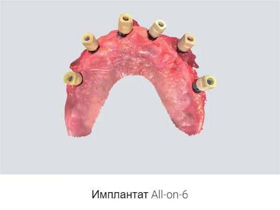3b7ysmpzxjetmgml4cg7goc9gy694inc.png 3b7ysmpzxjetmgml4cg7goc9gy694inc.png