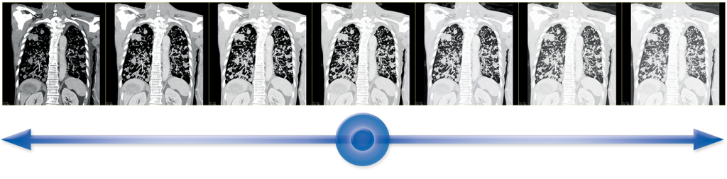 ct-aquilion-lightning-80-benefits-hybridview.png ct-aquilion-lightning-80-benefits-hybridview.png