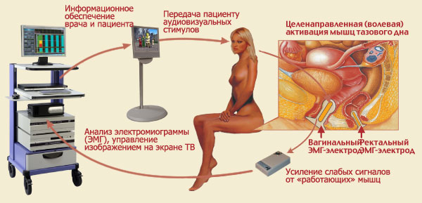 ЛЕЧЕНИЕ НЕДЕРЖАНИЯ МОЧИ У ЖЕНЩИН МЕТОДОМ БОС ЛЕЧЕНИЕ НЕДЕРЖАНИЯ МОЧИ У ЖЕНЩИН МЕТОДОМ БОС