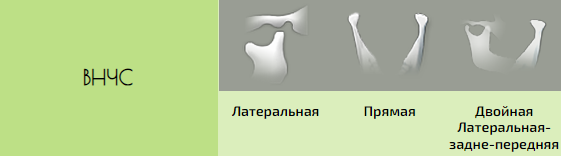 35.PNG