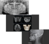 PointNix Point 3D Combi 500