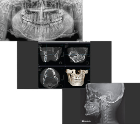 PointNix Point 3D Combi 500