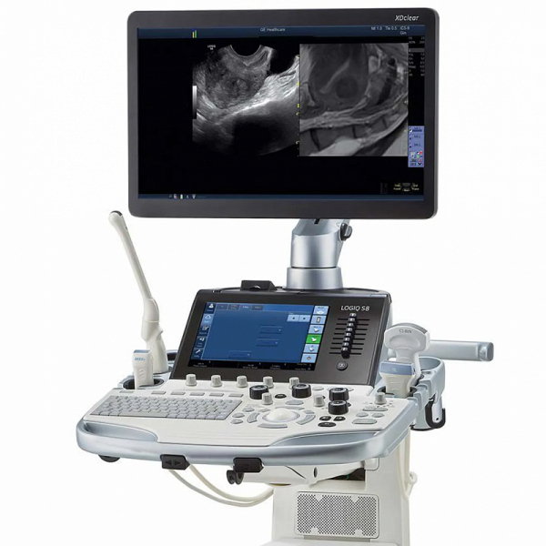 GE Logiq P8