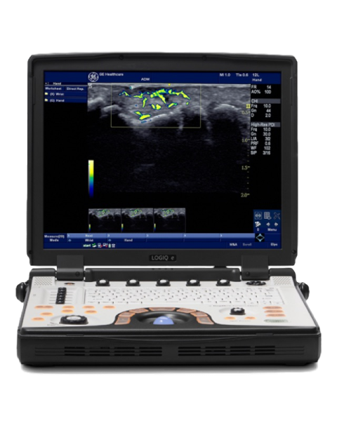 GE Logiq E BT12
