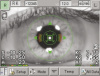 Tomey RC-5000