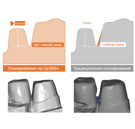 Стоматологический 3D сканер Up360+