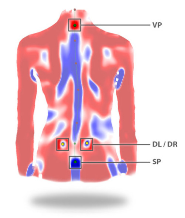 DIERS Formetric 4D (60 кадров)